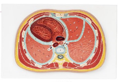 胸腔橫斷