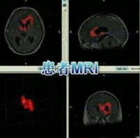 MRI設備結構虛擬仿真教學系統(tǒng)