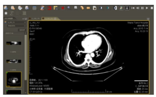 醫(yī)學影像診斷電子閱片系統(tǒng)