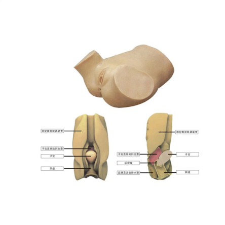 JD/YQC陰道后穹窿穿刺模型