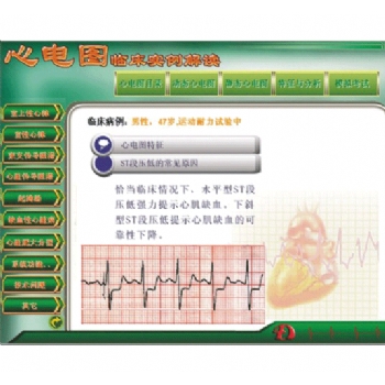 新版心電圖教學(xué)軟件心電圖臨床實例解讀